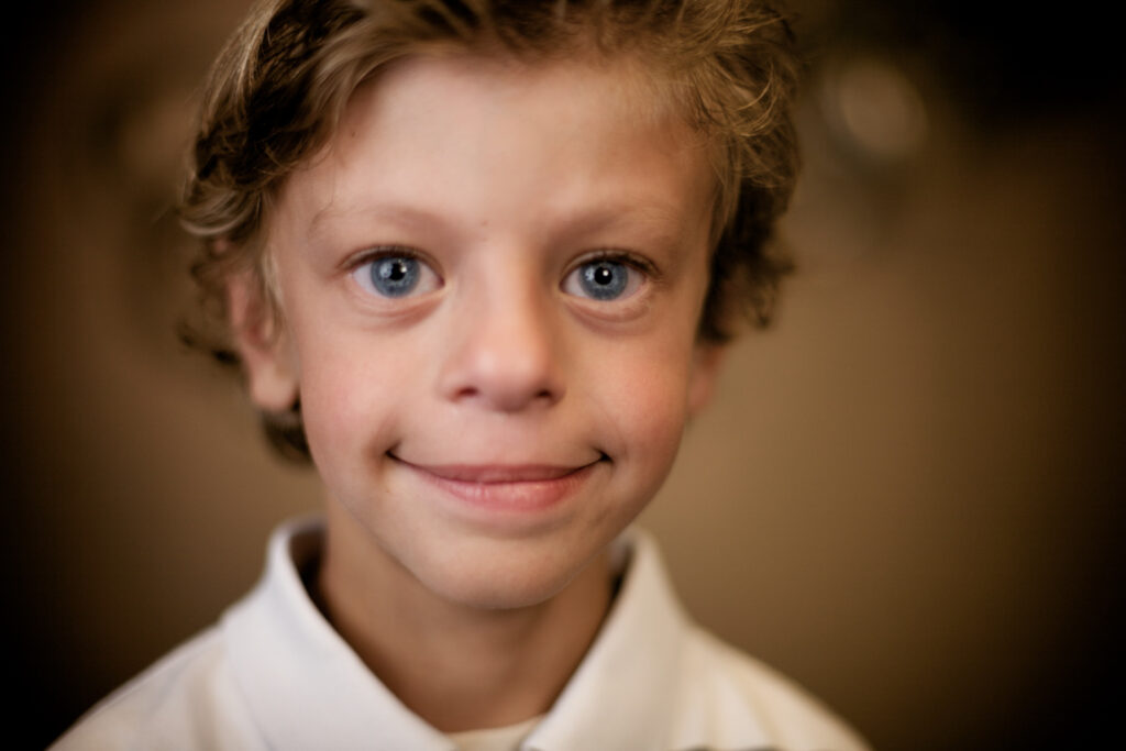 Williams Syndrome: A Rare Genetic Condition